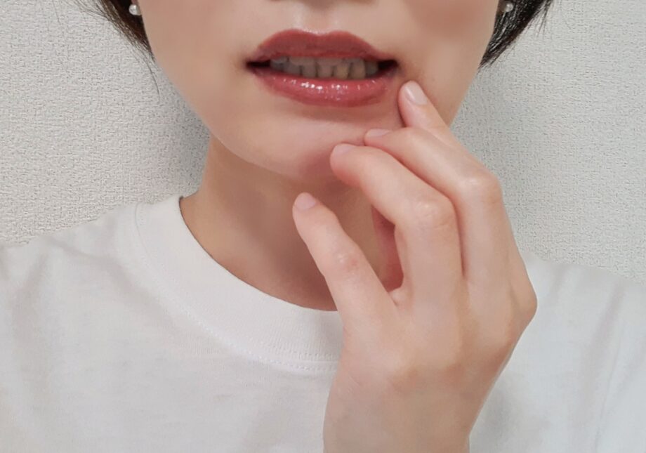 【連載59】ちょっと役立つ口腔と歯の話:テーマ「舌のヒリヒリ」横浜市旭区・ふたまたがわ歯科口腔外科